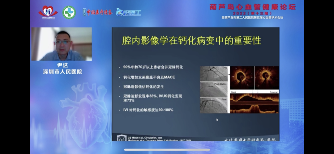 葫蘆島心血管健康論壇?2022｜創(chuàng)新驅(qū)動(dòng)發(fā)展，不斷提升心血管疾病救治能力(圖11)